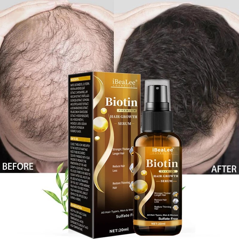 Hair care solution, strong hai - огляд і ціна Roots Nutrition & Fitness Inglewood Photos