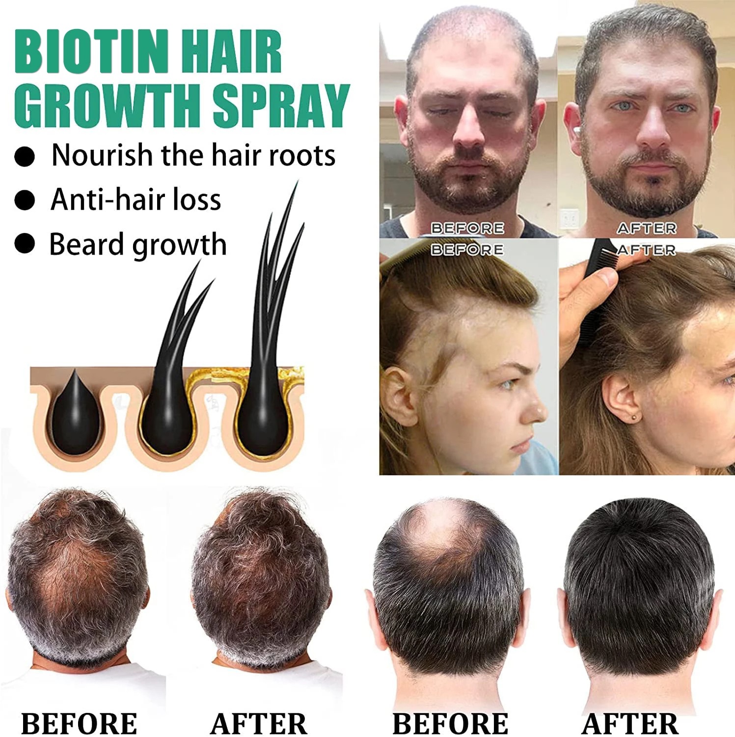 Hair care solution, strong hai - огляд і ціна Roots Nutrition & Fitness Inglewood Photos