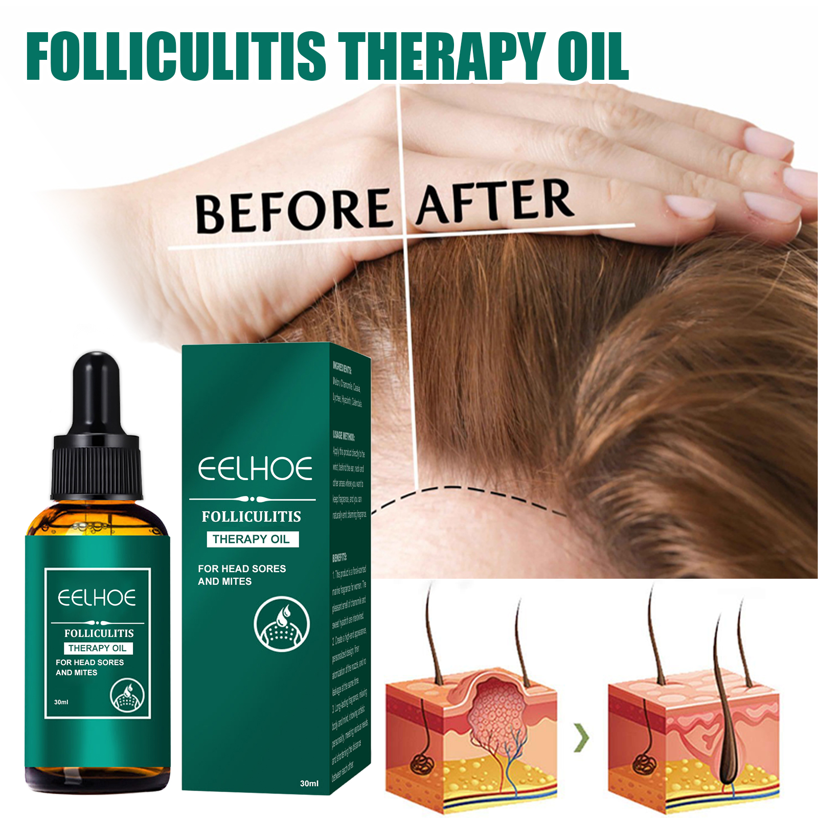 Scalp Treatment Serum Follicle - огляд і ціна Roots Nutrition & Fitness Inglewood Photos