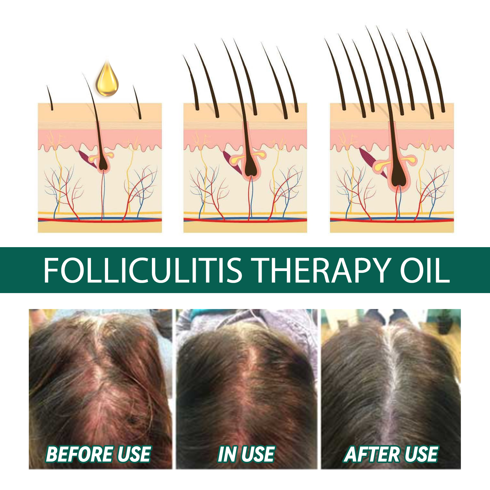 Scalp Treatment Serum Follicle - огляд і ціна Roots Nutrition & Fitness Inglewood Photos
